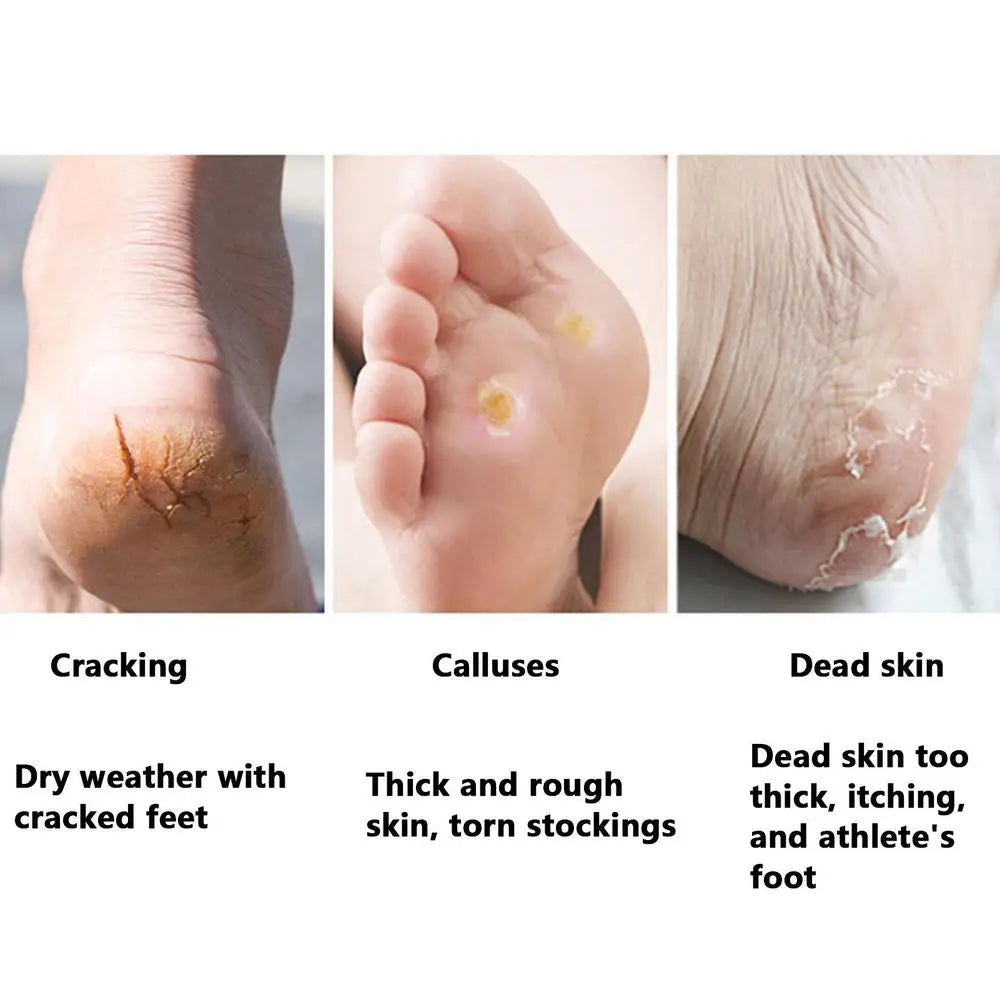 Stainless Foot Scraper