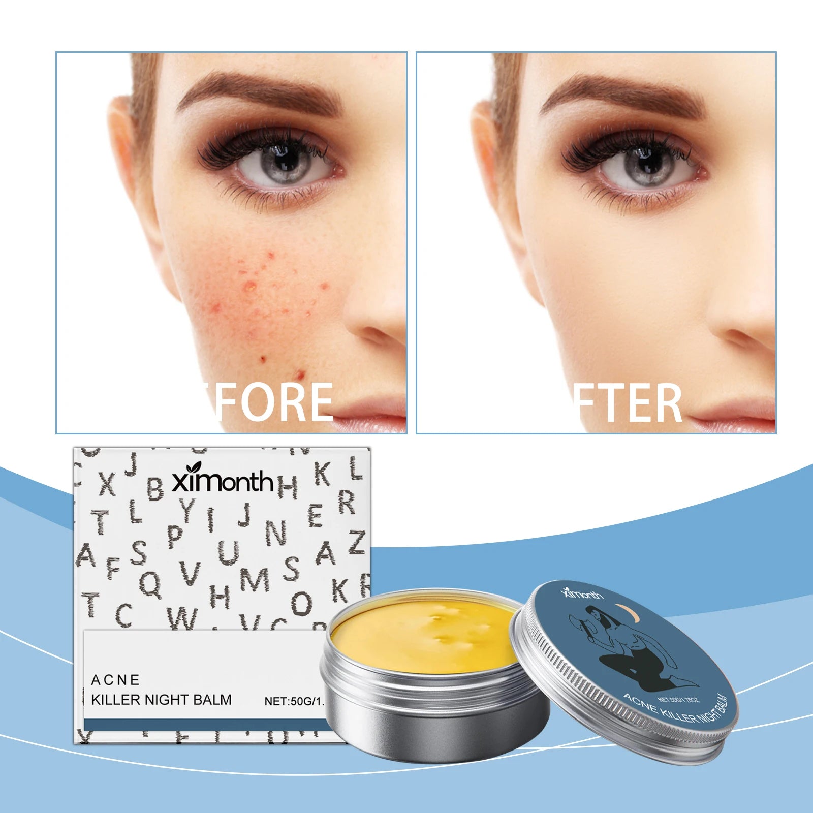 ClearSkin Acne Cream