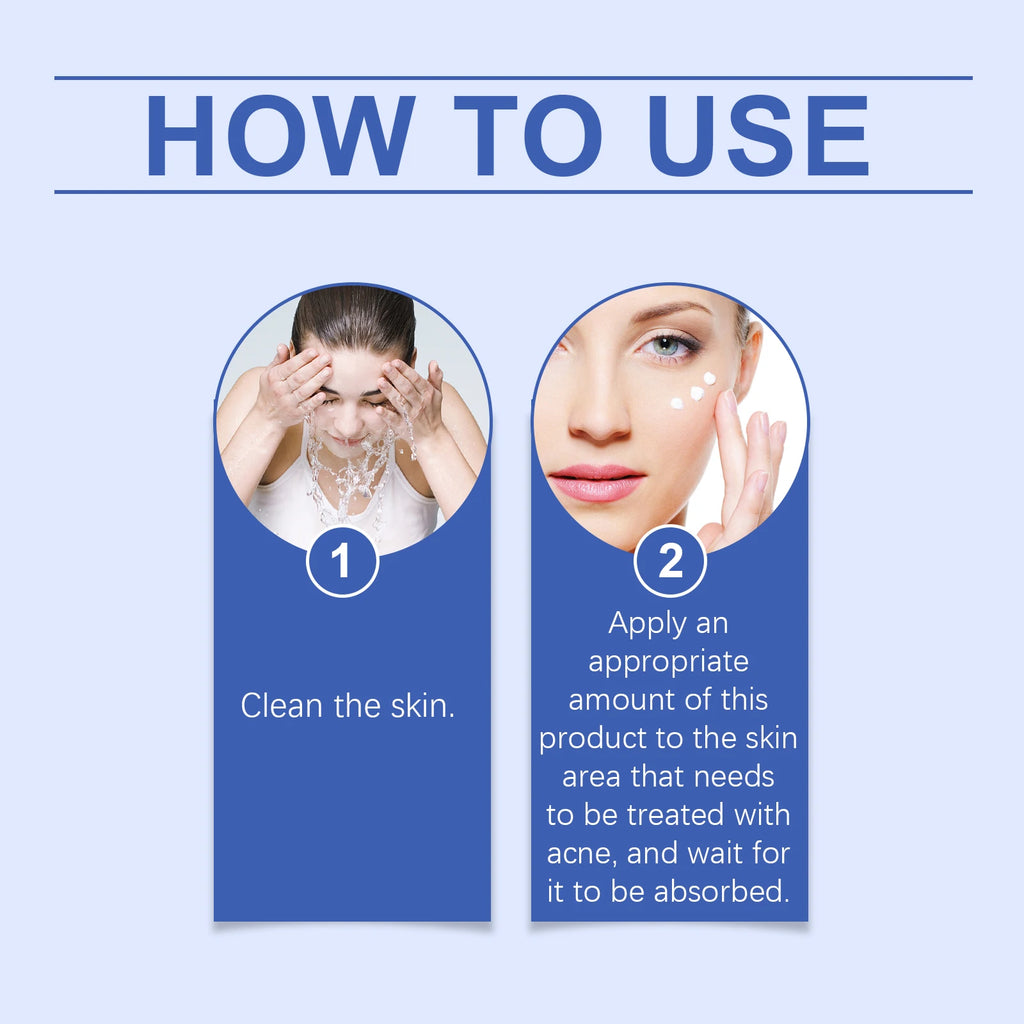 Clear Acne Cream