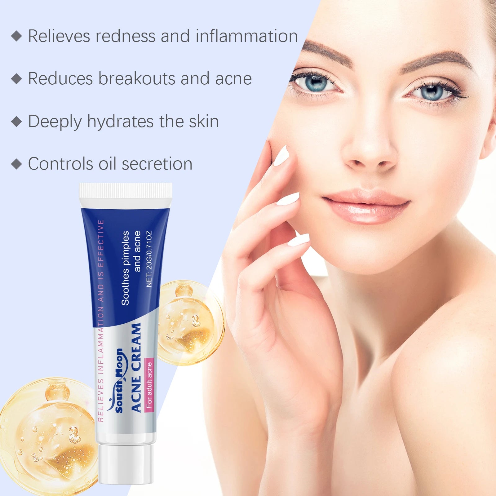 Clear Acne Cream