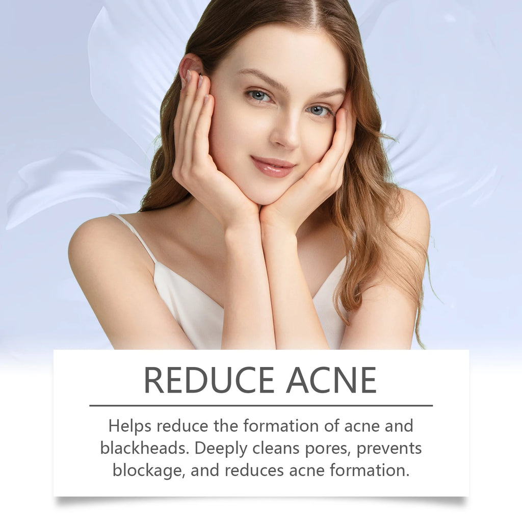 Clear Acne Cream