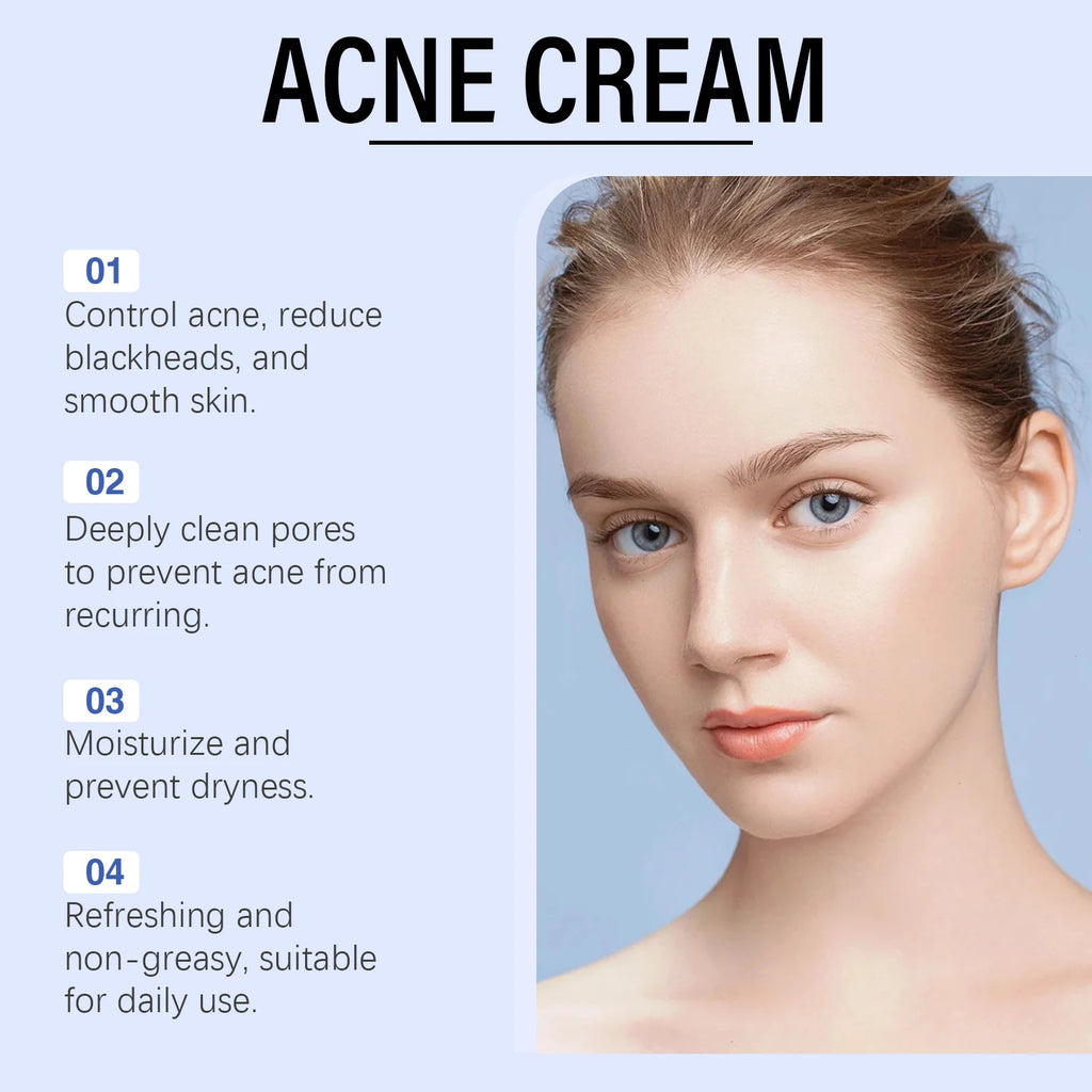 Clear Acne Cream
