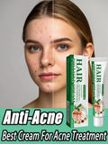 acne cream
best acne cream
pimple removal cream
oil control face cream
acne treatment cream
acne repair cream
face moisturizer for acne
blemish removal cream
anti acne cream
skincare for acne prone skin
moisturizing acne cream
acne spot treatment
pore minimizing cream
clear skin cream
acne care moisturizer
acne face moisturizer
cream for oily skin
facial cream for pimples
skin repair cream
acne solution cream