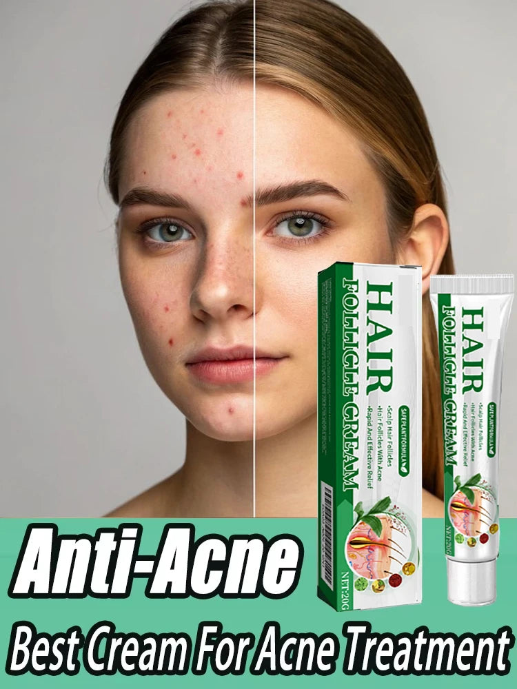 acne cream
best acne cream
pimple removal cream
oil control face cream
acne treatment cream
acne repair cream
face moisturizer for acne
blemish removal cream
anti acne cream
skincare for acne prone skin
moisturizing acne cream
acne spot treatment
pore minimizing cream
clear skin cream
acne care moisturizer
acne face moisturizer
cream for oily skin
facial cream for pimples
skin repair cream
acne solution cream
